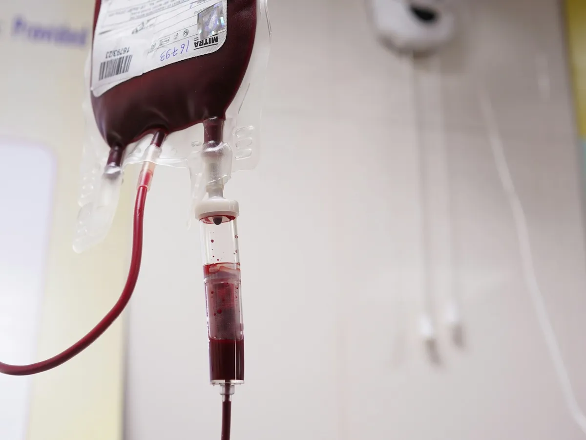 A collected unit of blood in a sealed transfusion bag