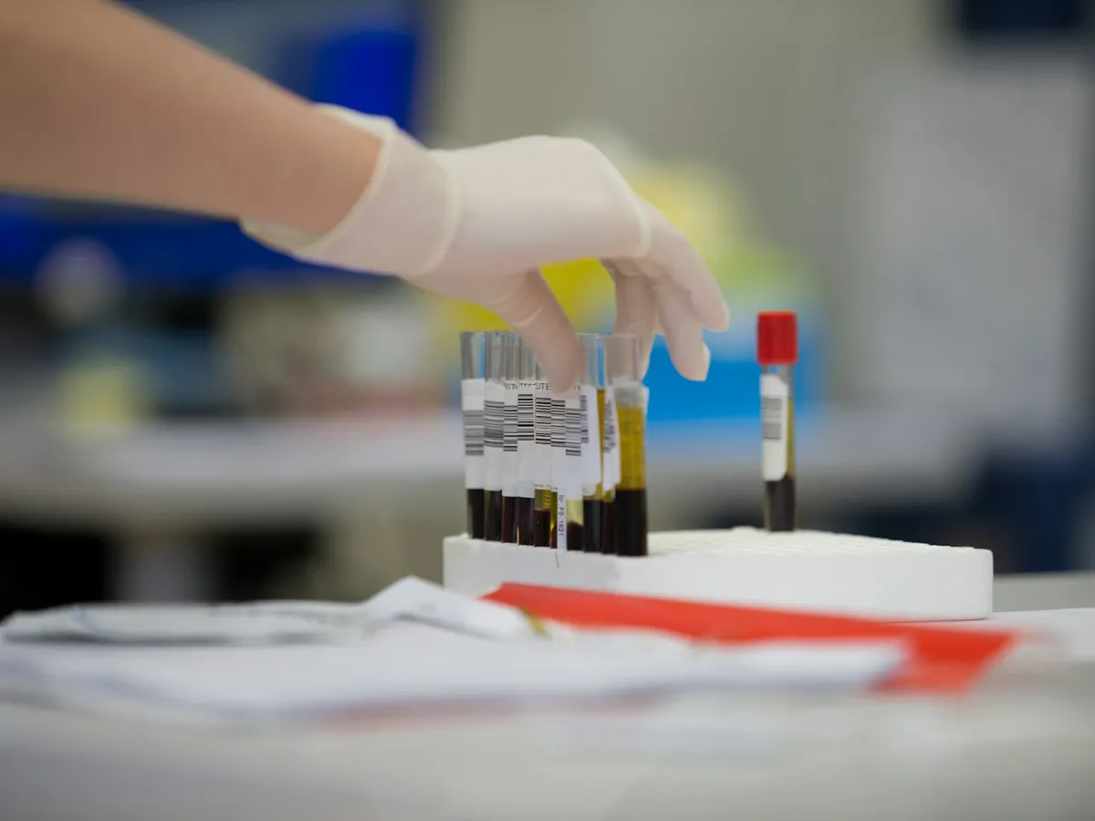 Labelled blood sample tubes being handled in a testing laboratory